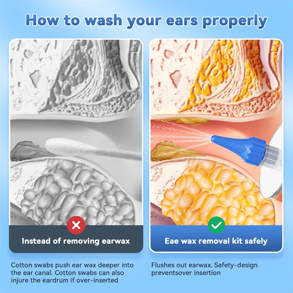 EAR WAX Removal คู่มือทําความส - Urban Farming System บทวิจารณ์และราคา